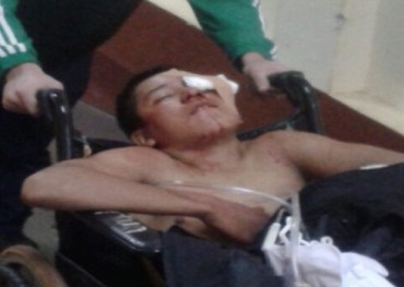 Dueño de Trutas Bar balea en el ojo a un adolescente