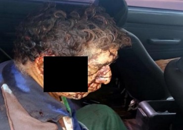 Hombre es herido con un machete